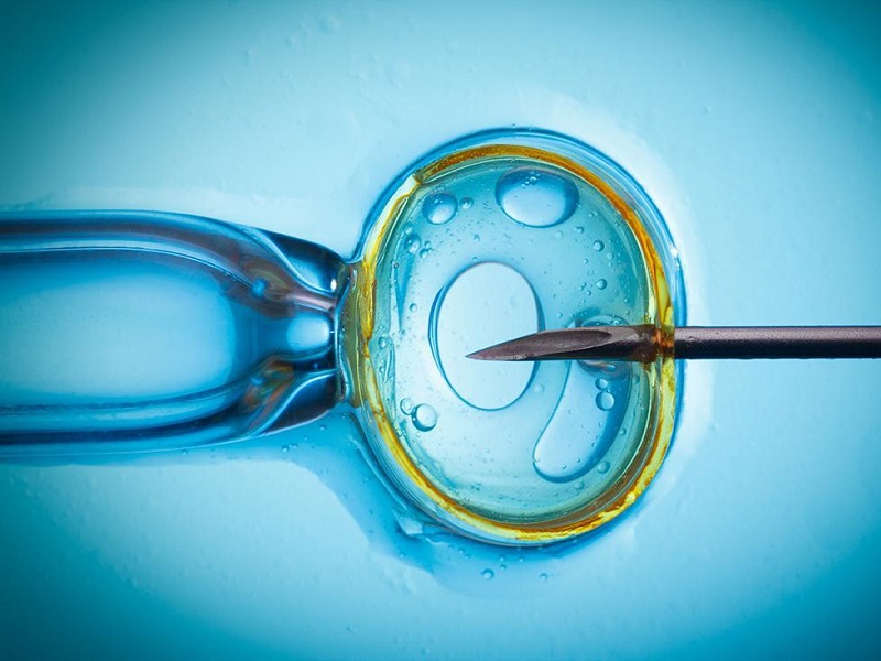 会鲤鱼吸水的女人