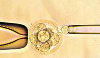 兰州试管婴儿技术